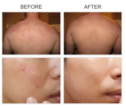 Image of Super Vitamin C Serum Facial Cream