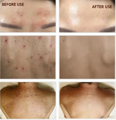 Image of Super Vitamin C Serum Facial Cream