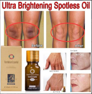 Spotless Skin Oil