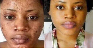 Get Rid of wrinkles, Dark spots and Lack of water problem & Get a Celebrity Glowing Skin