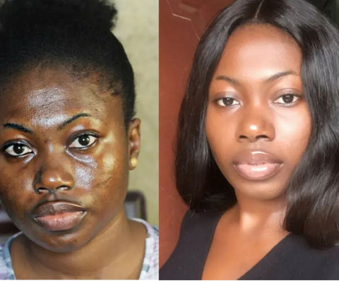 Image of Get Rid of wrinkles, Dark spots and Lack of water problem & Get a Celebrity Glowing Skin